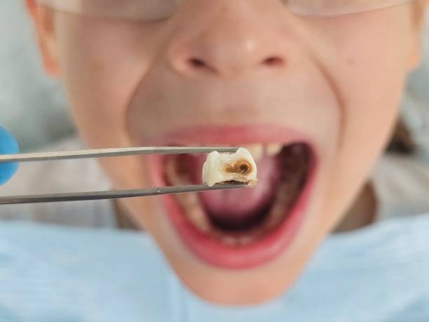 Best Emergency Dentist for Kids  in Red Lake, AZ
